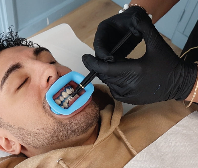 Formation blanchiment dentaire