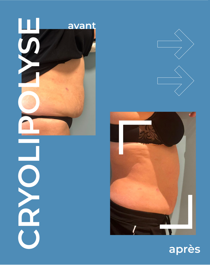 Résultats visibles et durables